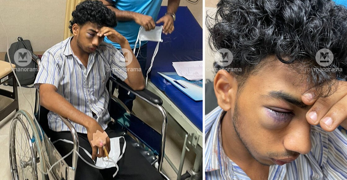Mohammed Midhulaj has been admitted to the Medical College Hospital in Kozhikode. Photos: Special arrangement 
