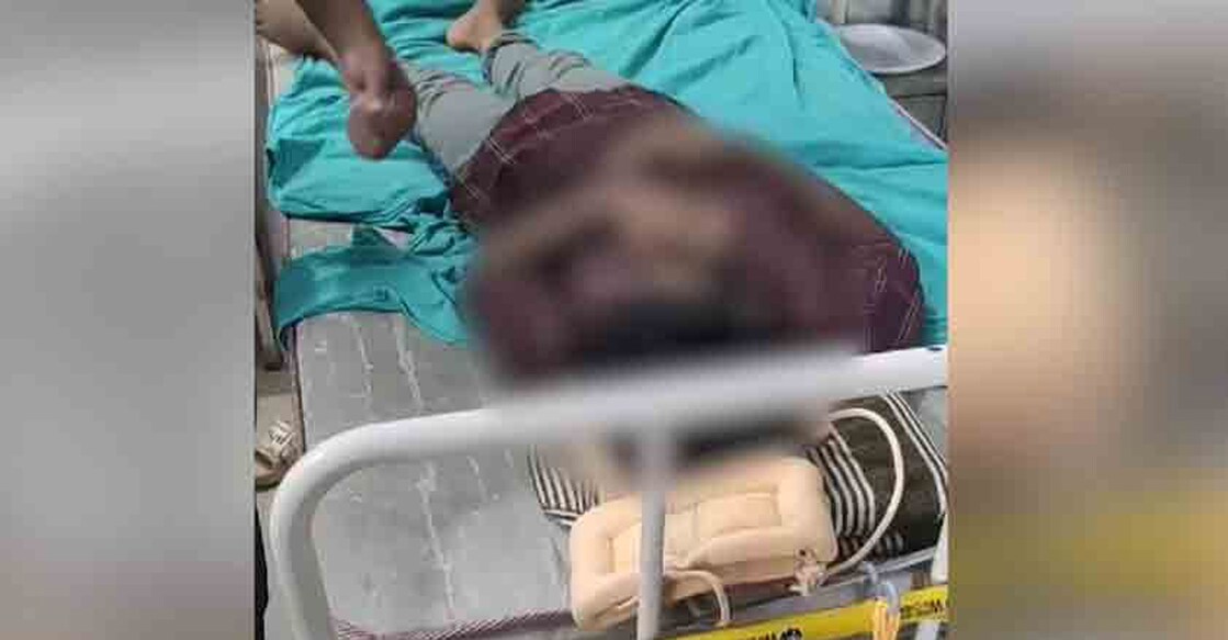 The boy currently undergoing treatment at Manjeri Medical College Hospital with injuries suffered from the attack.  Photo: Manorama News