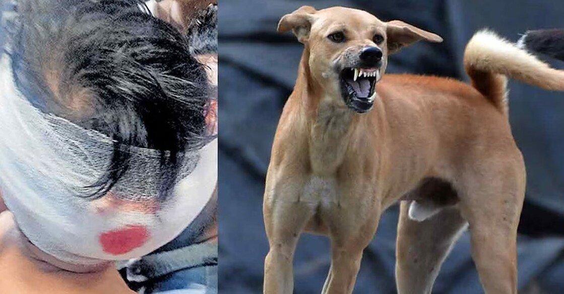 A toddler was attacked and dragged away by a street dog here in Trikkarippur. Photo: Manorama, (2) Representational image.