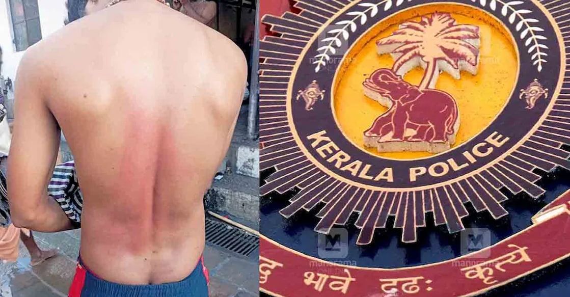 sabarimala-pilgrim-thrashed Rajesh was admitted to the Government Hospital at Sannidhanam. Photo: Manorama