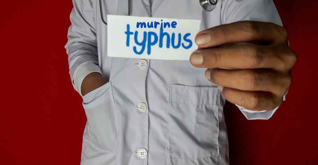 Murine typhus. Photo: Canva/Onmanorama