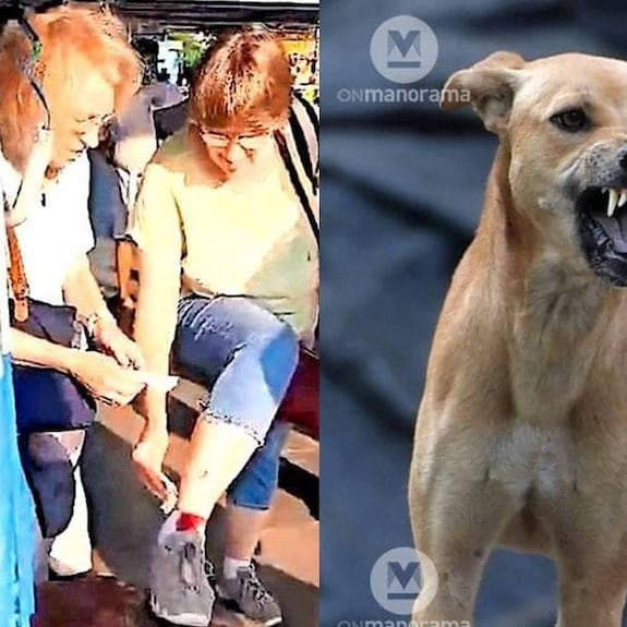 German woman bitten by stray dog at Kozhikode railway station Onmanorama