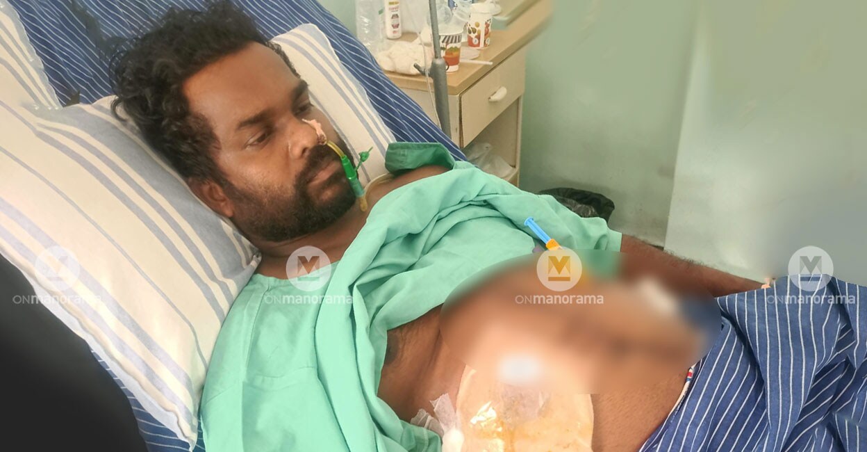 jiju-suresh-stab-victim Jiju Suresh, whose small and large intestines were torn, had to undergo a three-hour life-saving surgery in a hospital in Mangaluru. Photo: Special arrangement