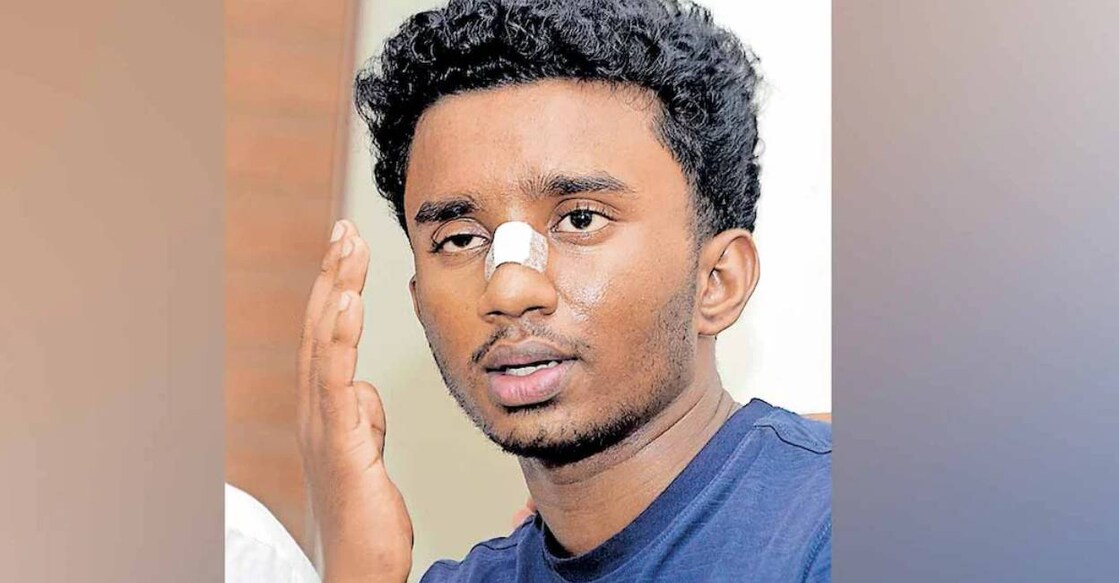 amal-kozhikode-sfi-violence C R Amal Krishna, from R Sankar Memorial SNDP Yogam Arts and Science College at Kollam in Koyilandy raised the complaint against SFI. Photo: Manorama
