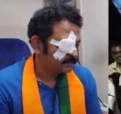 Krishnakumar's eye injury: Plot twist as cops find accused is BJP worker