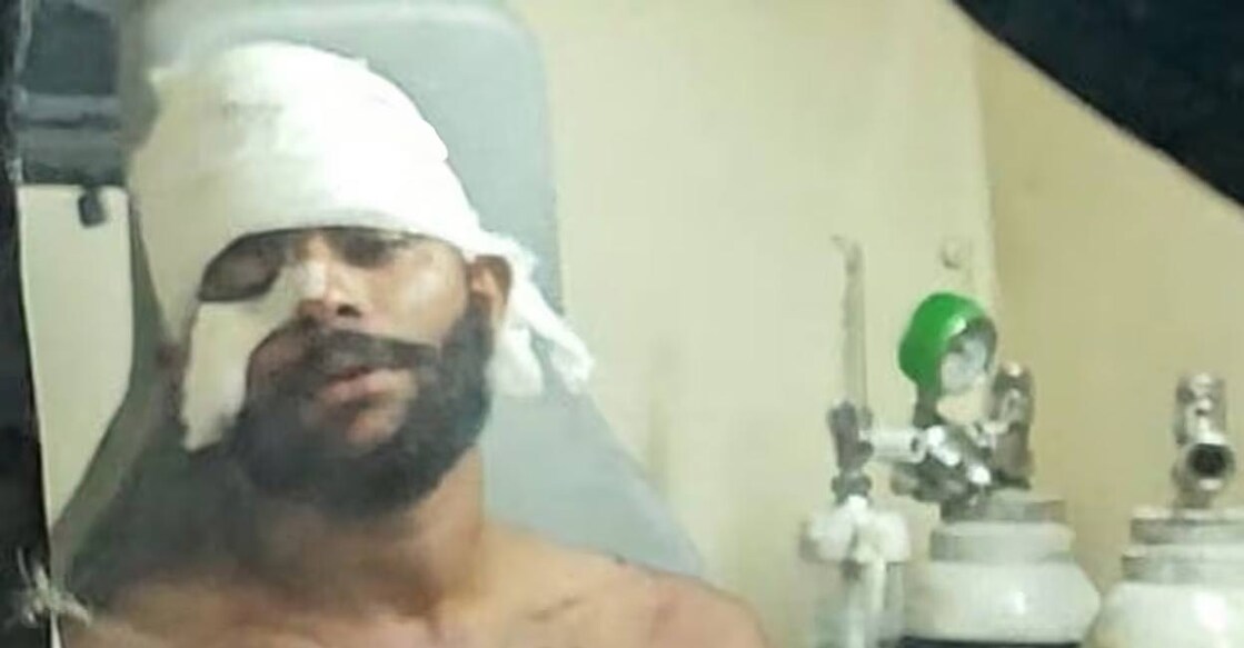 Luhaib (24), who hails from Areekode, sustained stab injuries to his face and head and has been admitted to the Medical College Hospital in Kozhikode. Photo: Special arrangement.
