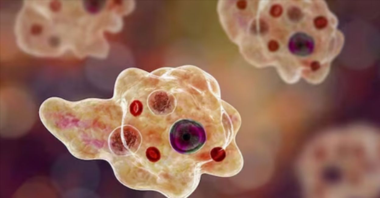 Representational graphic