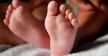 Child born with deformities discharged after long hospital stay in Alappuzha