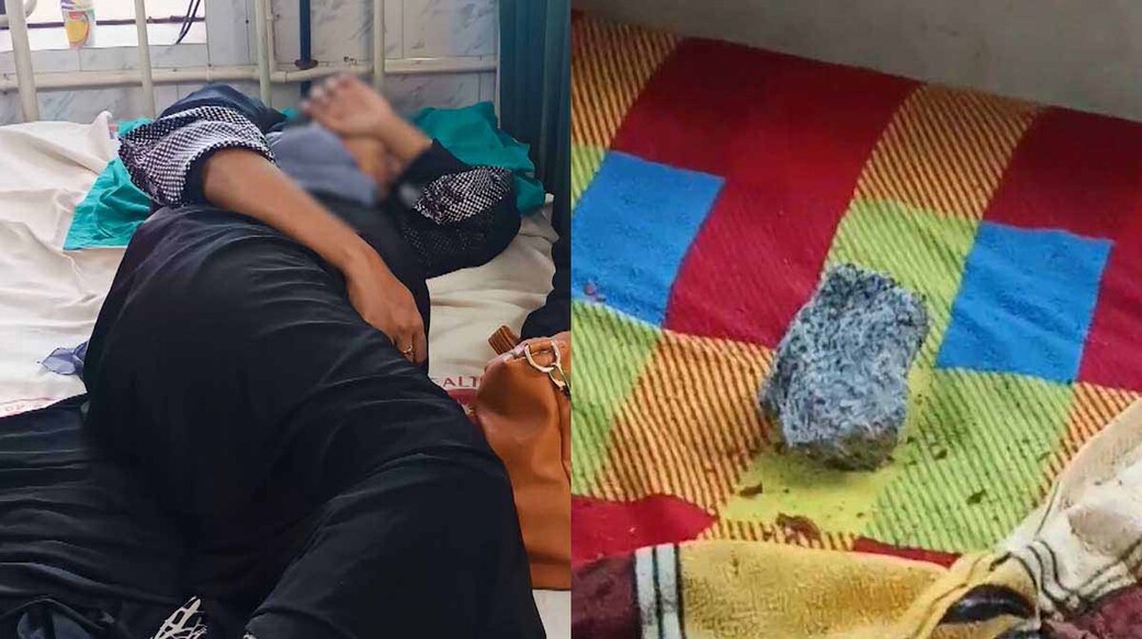 Farbeena (l), the rock  that struck her leg. Photo: Manorama News