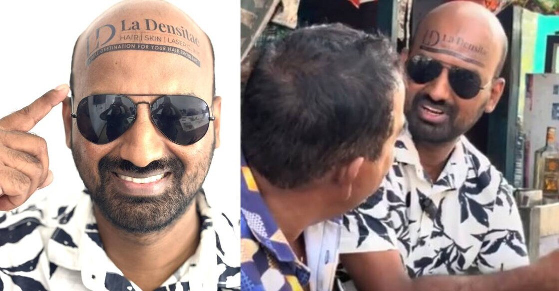 Shafeek shows advertisement on his bald head. Photo: Facebook/ Shafeek Hashim
