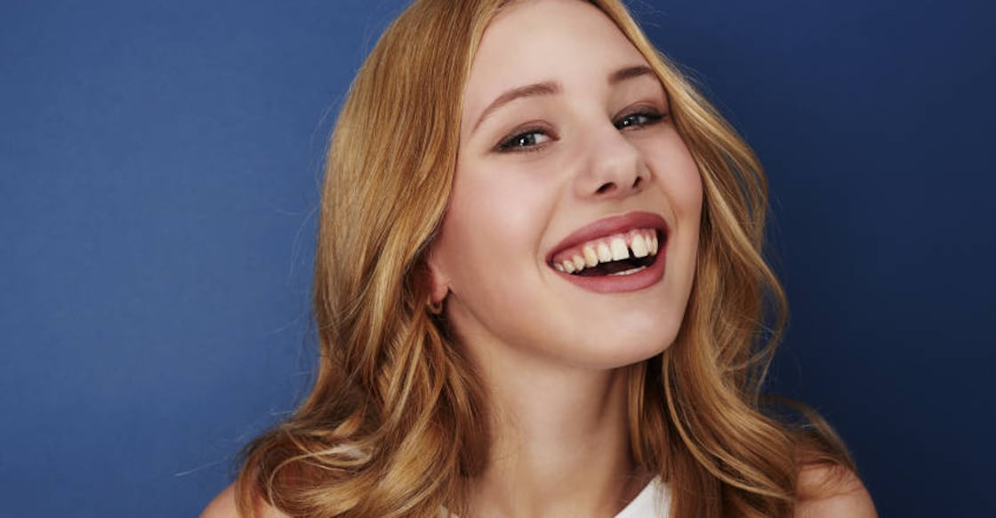 teeth-gap