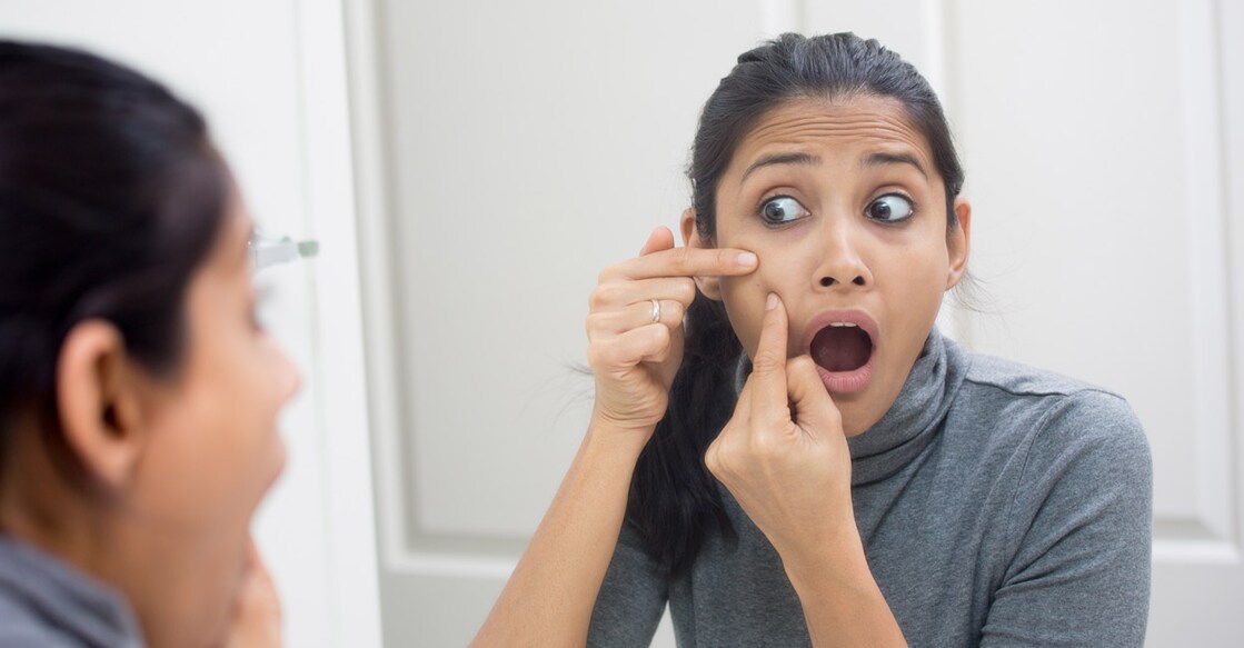 Teenage skin becomes sensitive due to changing hormonal structure of the body and thus requires extra attention: Shutterstock/AshTproductions