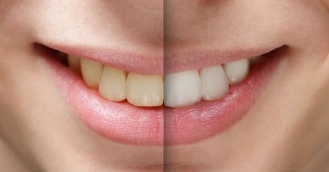 Six most unexpected beauty benefits of mustard oil