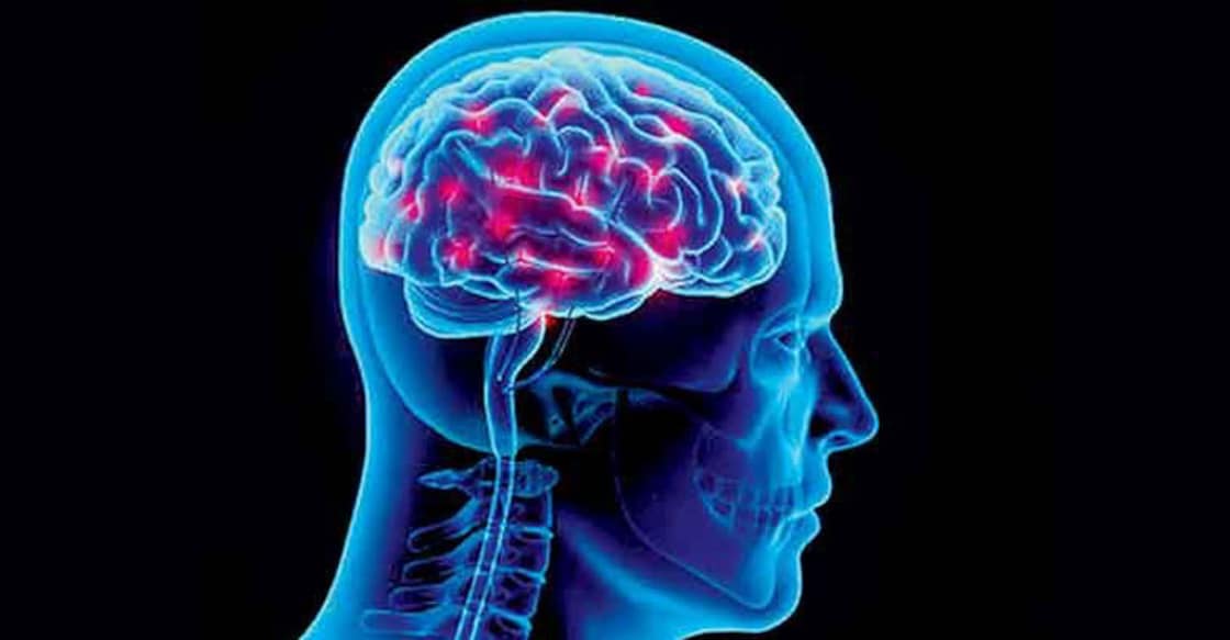 Scans on US diplomats in Cuba show 'something happened to the brains' Scans on US diplomats in Cuba show 'something happened to the brains'