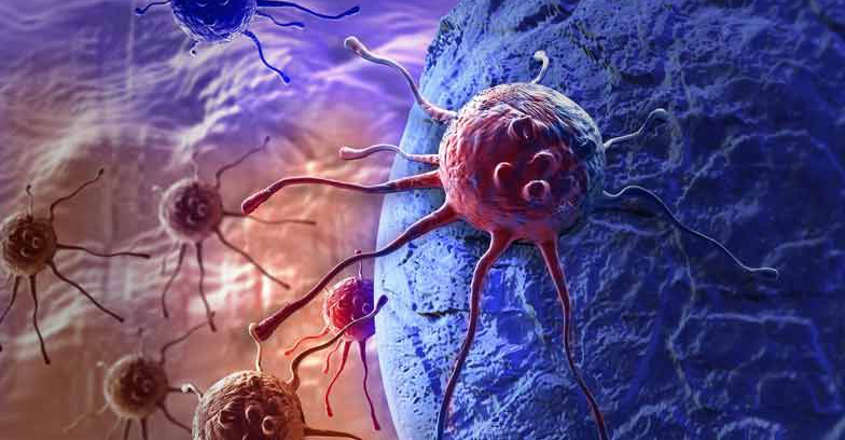 Aspirin may lower risk of ovarian cancer Aspirin may lower risk of ovarian cancer