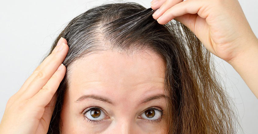 How stress can make your hair go grey
