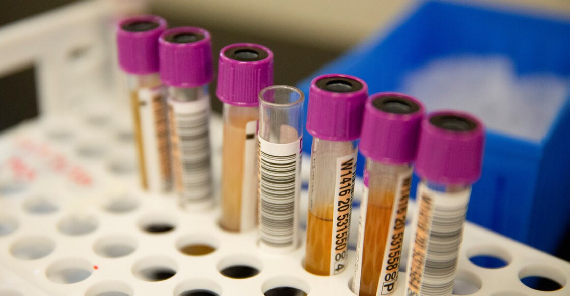 Kerala records 27 COVID deaths on Sunday, toll now at 2,049