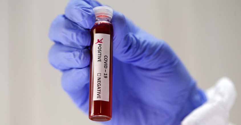 Coronavirus Coronavirus