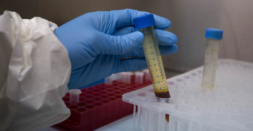 India needs more COVID-19 testing: Here is how it will save money and lives India needs more COVID-19 testing: Here is how it will save money and lives