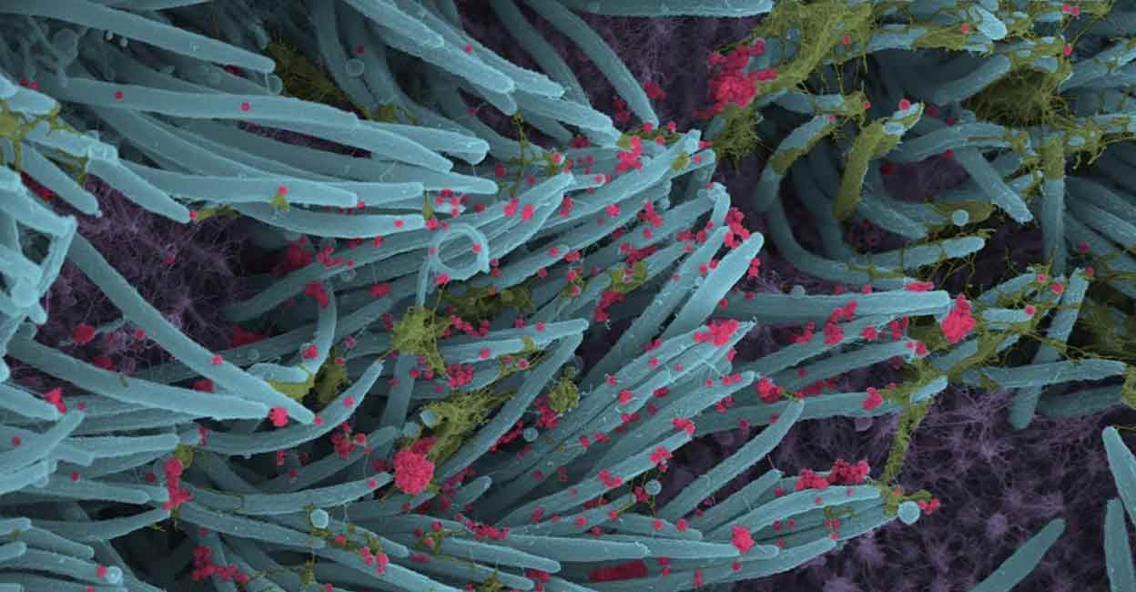 A higher power magnification image shows the structure and density of SARS-CoV-2 virions (red) produced by human airway epithelia. (Photo: Ehre Lab, UNC School of Medicine) A higher power magnification image shows the structure and density of SARS-CoV-2 virions (red) produced by human airway epithelia. Image courtesy: IANS