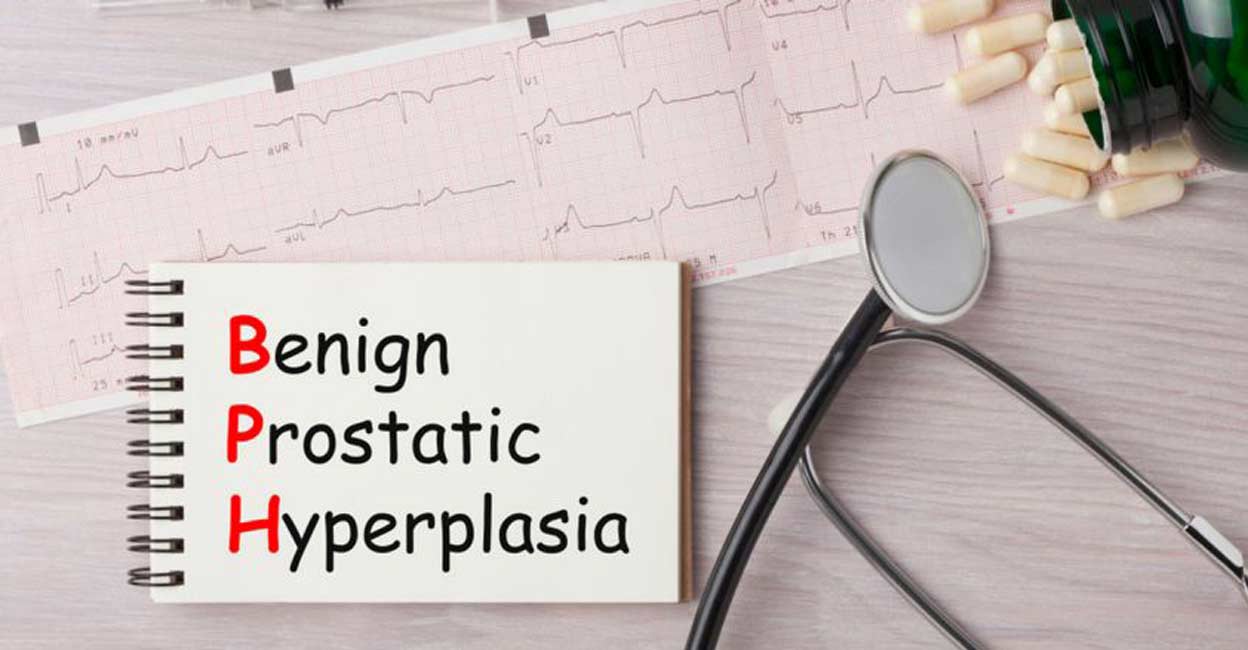 Hypertension and BPH have emerged as significant public health issues worldwide. Image courtesy: ogichobanov / Shutterstock