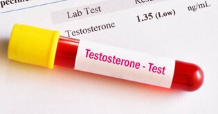 Low levels of testosterone in men linked to severe Covid risk