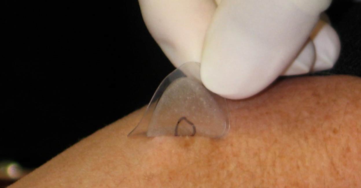 Cutaneous Sample Milan woman's skin sample may hold clues to COVID-19 origins ...