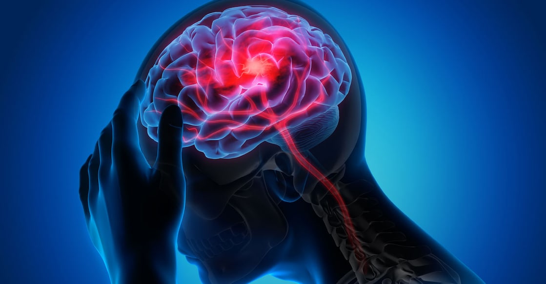 In Kerala, 152 in one lakh people suffer from stroke, while the national average is 93. Image courtesy: peterschreiber.media/Shutterstock