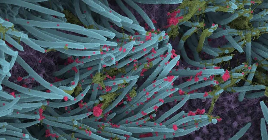 A higher power magnification image shows the structure and density of SARS-CoV-2 virions (red) produced by human airway epithelia. (Photo: Ehre Lab, UNC School of Medicine) A higher power magnification image shows the structure and density of SARS-CoV-2 virions (red) produced by human airway epithelia. Image courtesy: Ehre Lab, UNC School of Medicine/IANS
