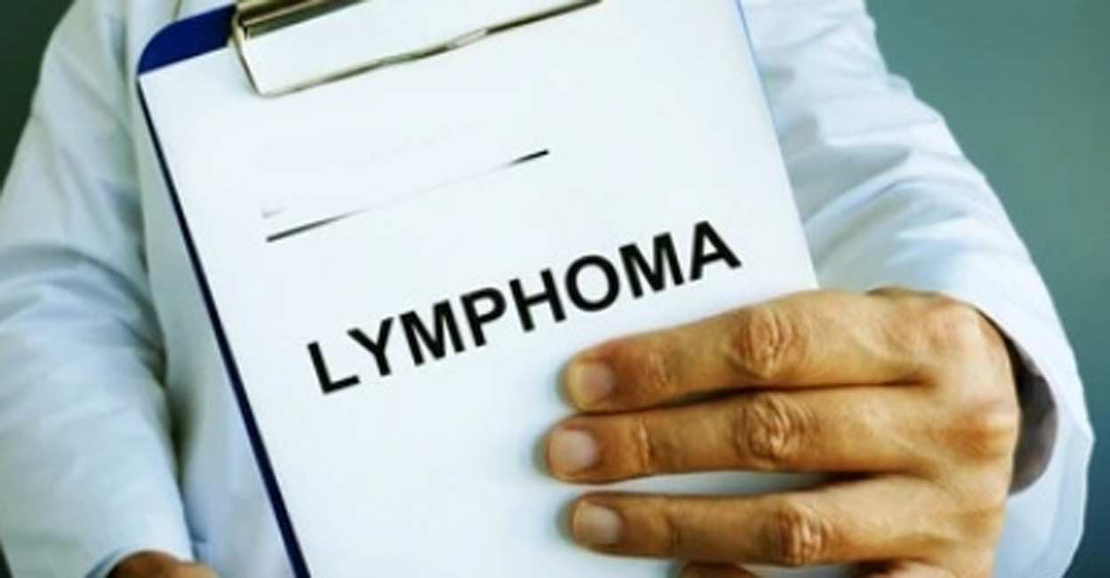 Early diagnosis key to cure lymphoma: Doctors