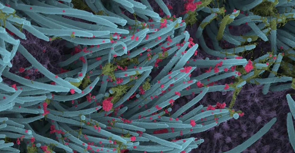 A higher power magnification image shows the structure and density of SARS-CoV-2 virions (red) produced by human airway epithelia. Image courtesy: IANS