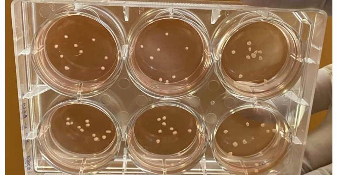 The organoids enable scientists to study how the human brain develops and communicates. Image courtesy: IANS