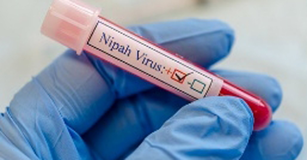 Nipah virus Representational image: IANS