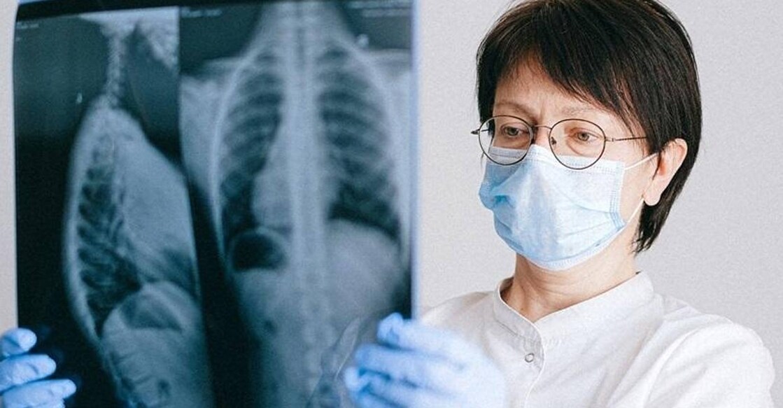 Representative image. Photo: IANS