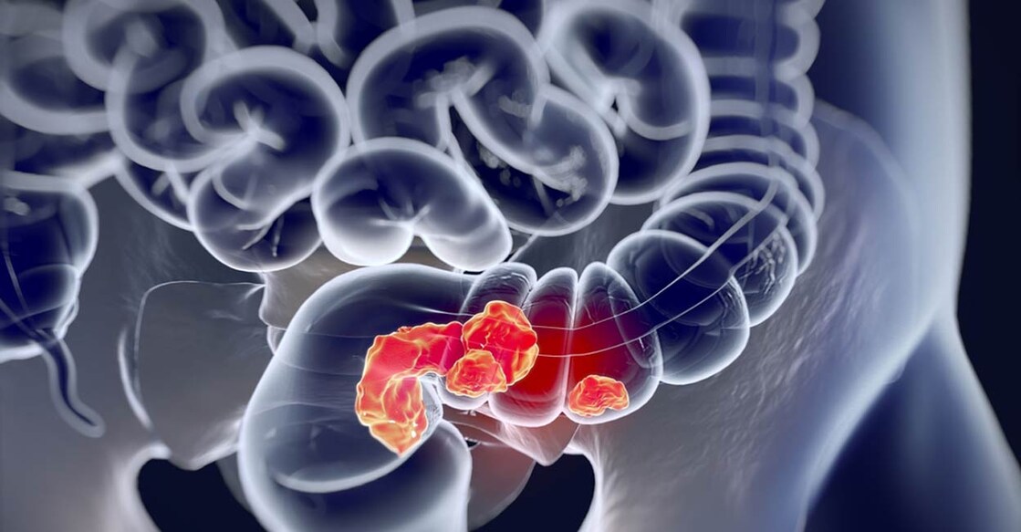 Representative image: Anatomy Image / Shutterstock