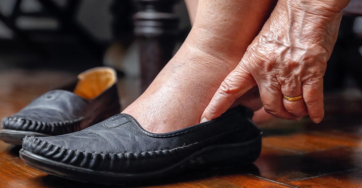 Wearing shoes Wearing shoes without socks will be a risk for diabetic patients. Representational image: Toa55/iStock