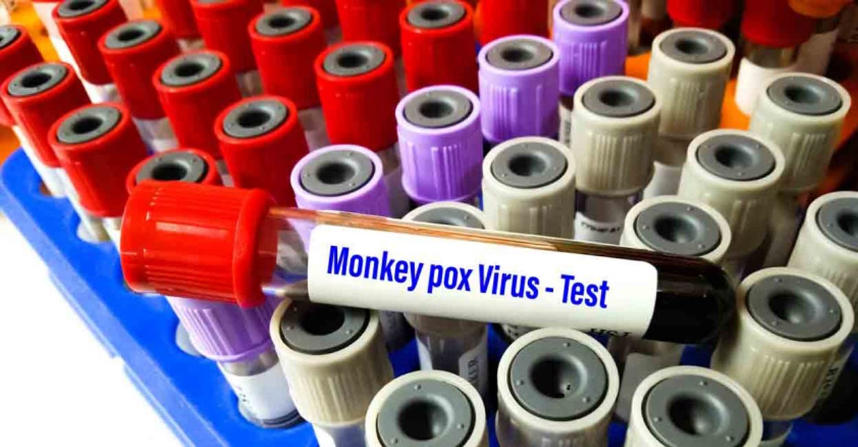 download monkey pox quarantine