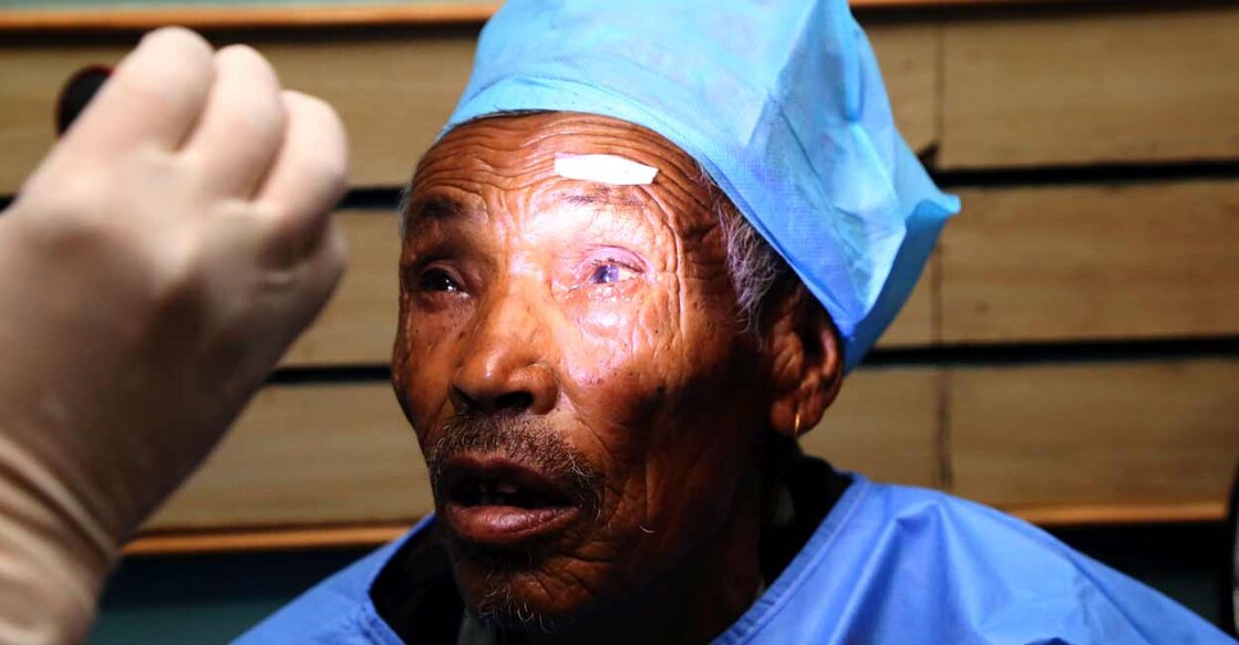 eye-health-c Representative image. Photo: IANS