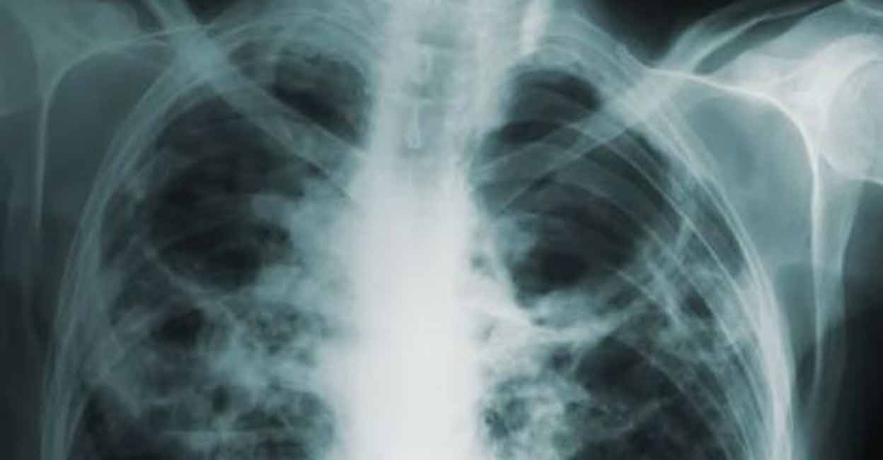 CT scan. Representative image. Photo: IANS