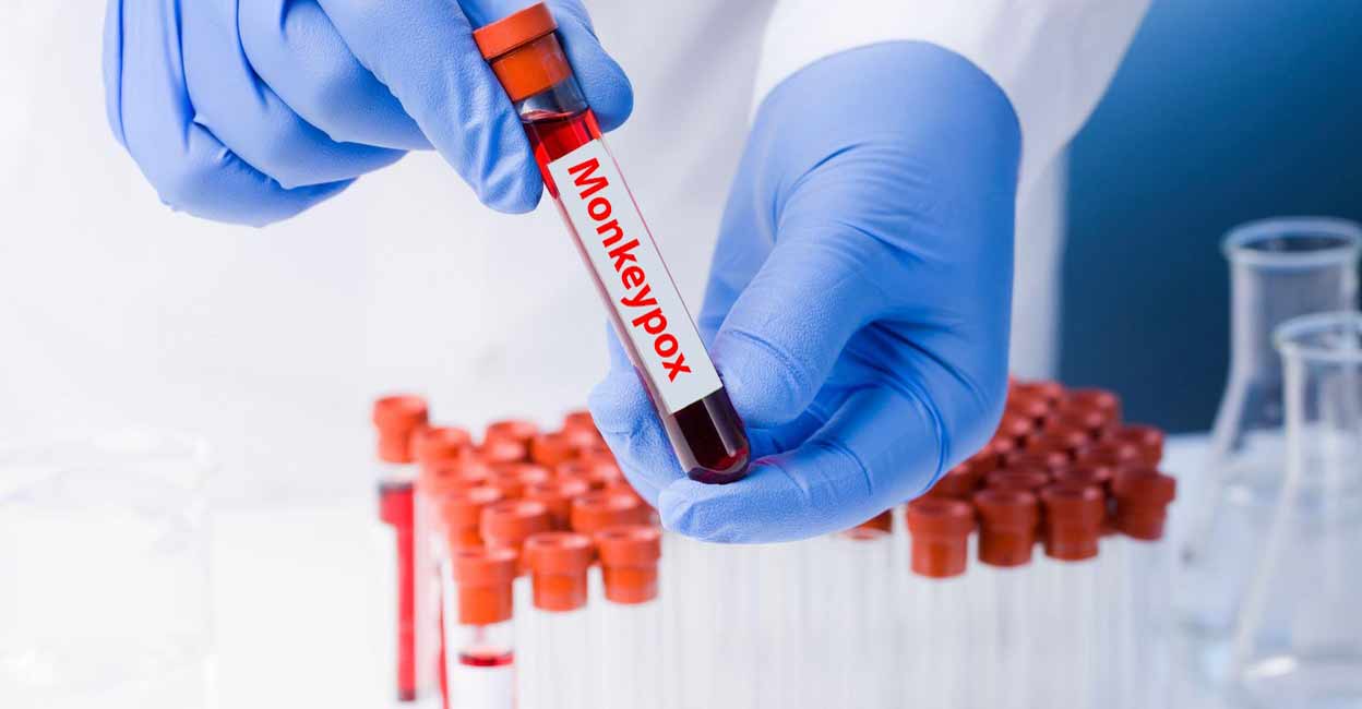 Representative image. Photo: IANS