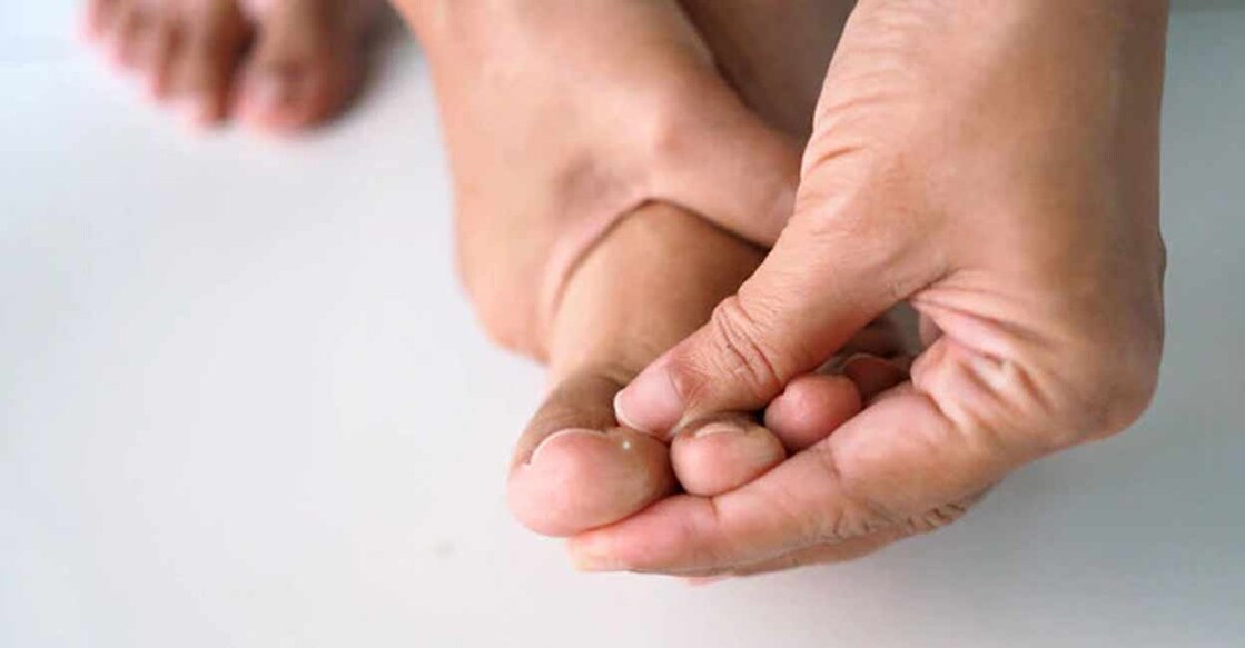 How to curb adverse effects of diabetes on your skin and feet