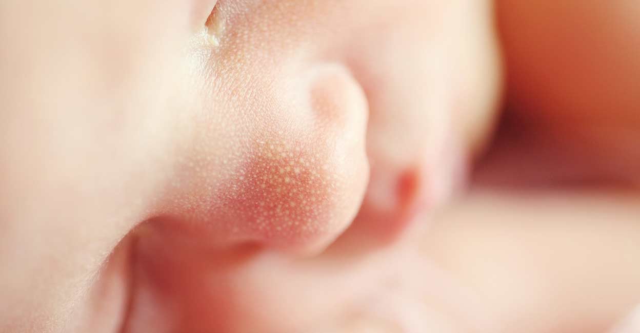 Baby. (File Photo: IANS) Representative image: Photo: IANS