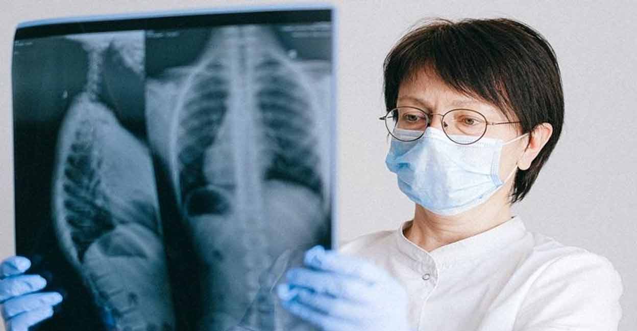 Parts most frequently affected by Rheumatoid Arthritis are the lungs, skin, eyes, digestive system, heart, and blood vessels. Representative image: IANS