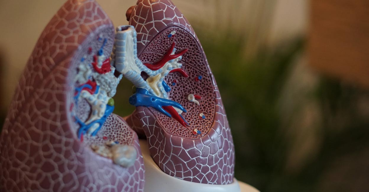 Mutation of the EGFR gene accounts for as many as 40 percent of cases in Asia. Image courtesy: IANS