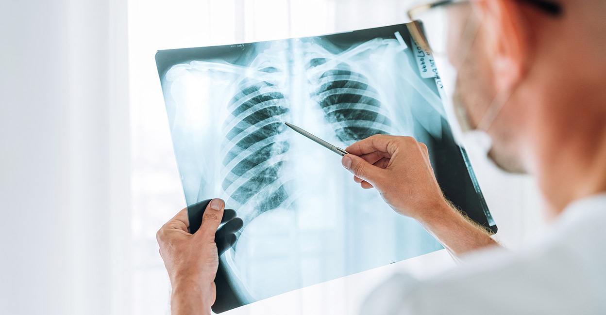lungs Those with more advanced lung cancer may present with complaints of headaches, indicating a spread to the brain, and bone pain or backache, indicating bone metastases. Photo: Soloviova Liudmyla / Shutterstock