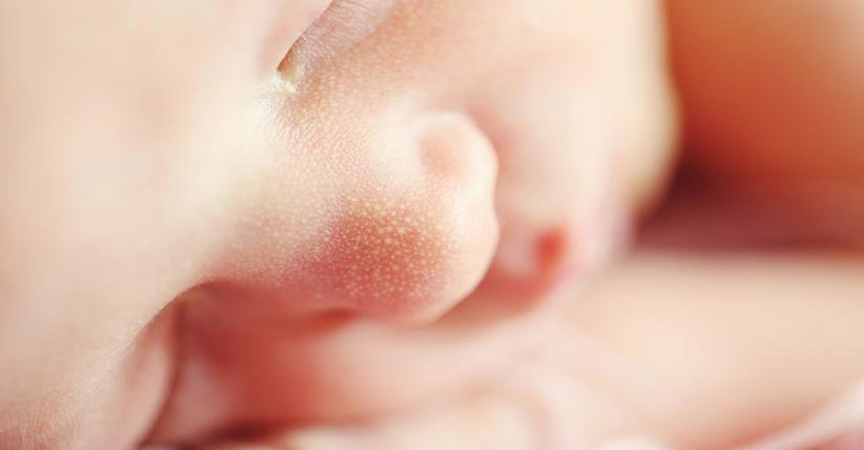 'The injection has been administered to the child, and he is now on the path to recovery,' Kejriwal posted on X. Representational image: IANS