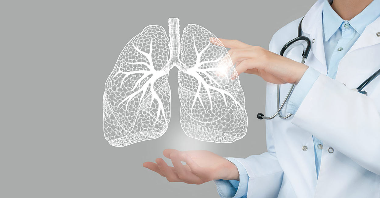 The main organ affected by tuberculosis is the lungs. Photo: Shutterstock/mi_viri