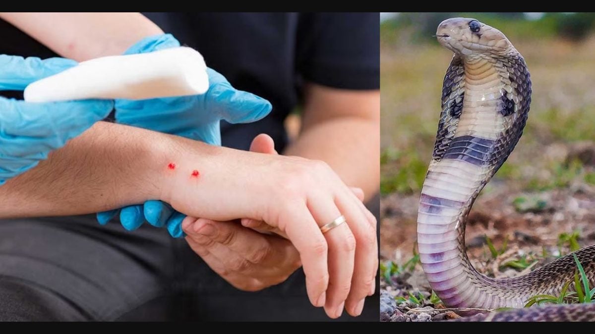 Snakebite's first aid steps to save lives while waiting for medical help |  Health | Onmanorama