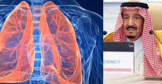 Saudi Arabia's King Salman's lung infection: What causes the condition? 