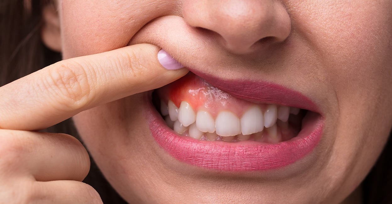 Do not ignore bleeding gums while brushing or flossing, thinking that it is quite common. Photo: iStock/AudreyPopov